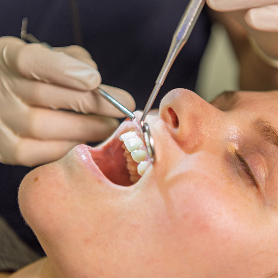 Frontzahnfüllungen in der ästhetischen Zahnheilkunde Frontzahnfüllungen in der ästhetischen Zahnheilkunde